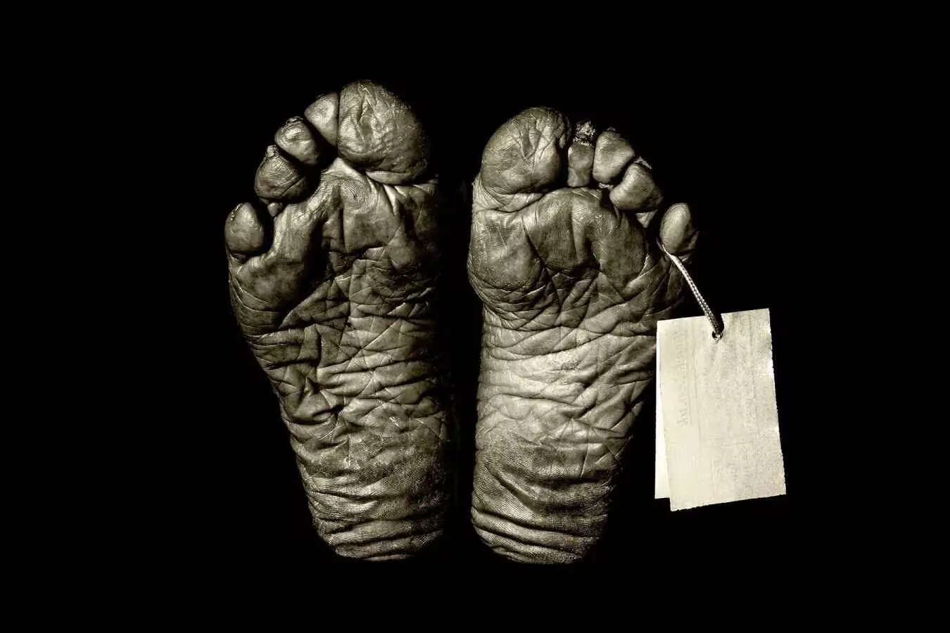 Feet with a morgue tag
